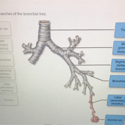 Bronchial tree image to label