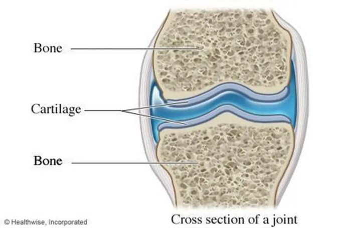 The presence of chondrocytes indicates that a tissue is ________.