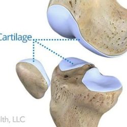 Cartilage 2677