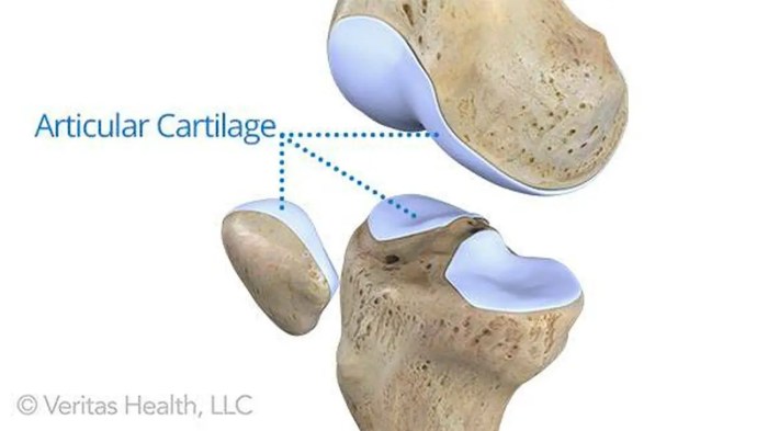 Cartilage 2677