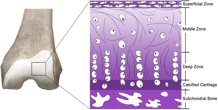 Cartilage arthritis articular 1324 knee skeletal healthiack joints